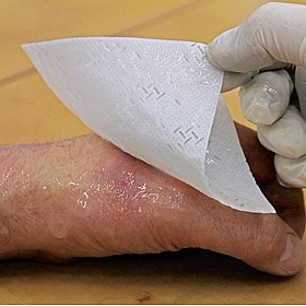 Workplace First Aid Burn Relief Dressing - Premises